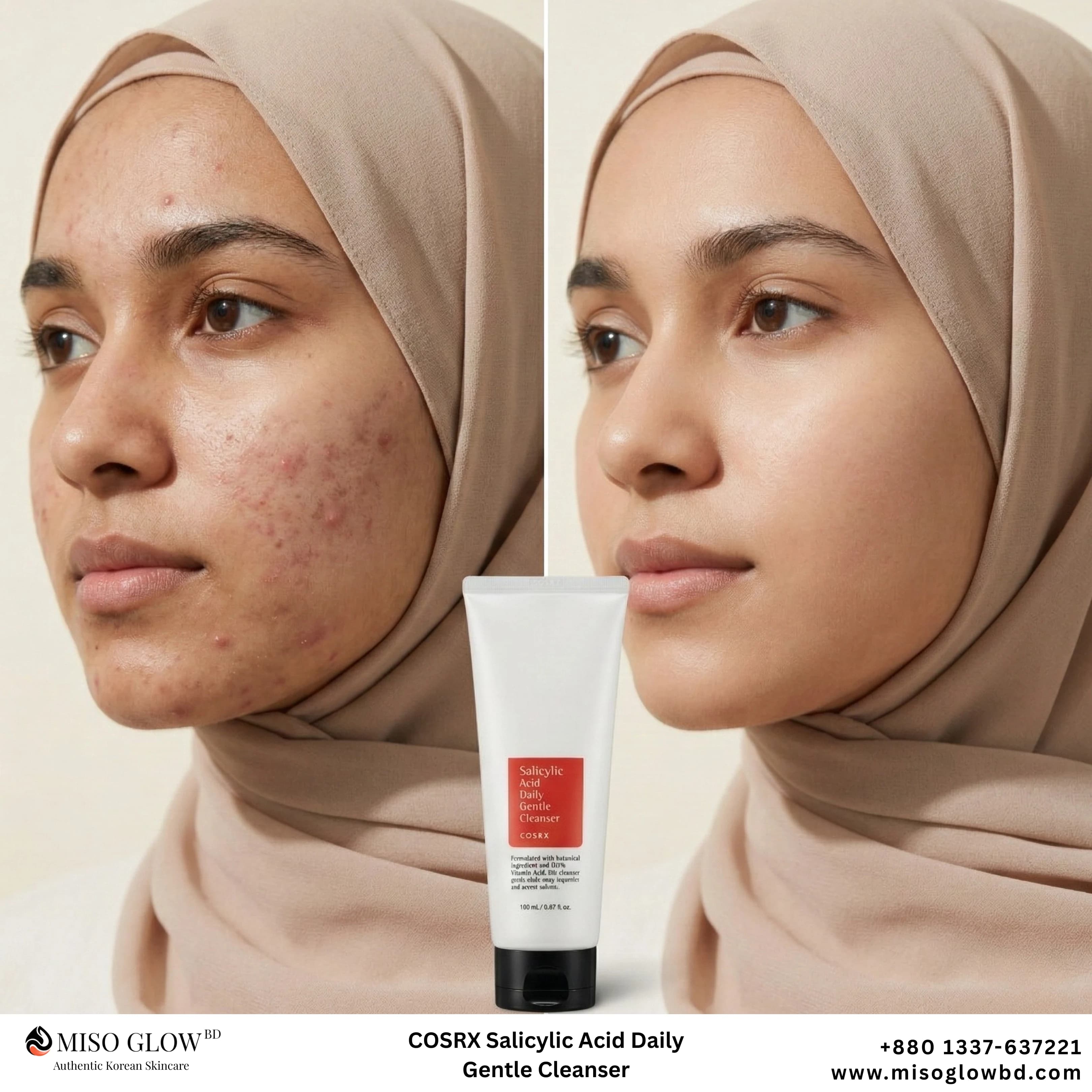 COSRX Salicylic Acid Daily Gentle Cleanser (50ml) - Image 1